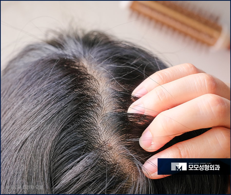 흰머리 가려움 어떻게 완화시킬 수 있을까요 관련 이미지 2