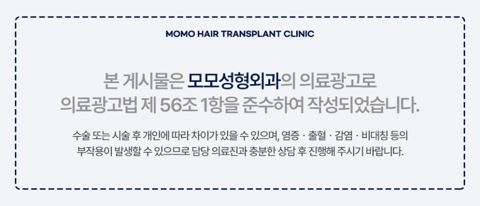 구렛나루 탈모 퍼스널 디자인으로 자연스럽게 관련 이미지 12