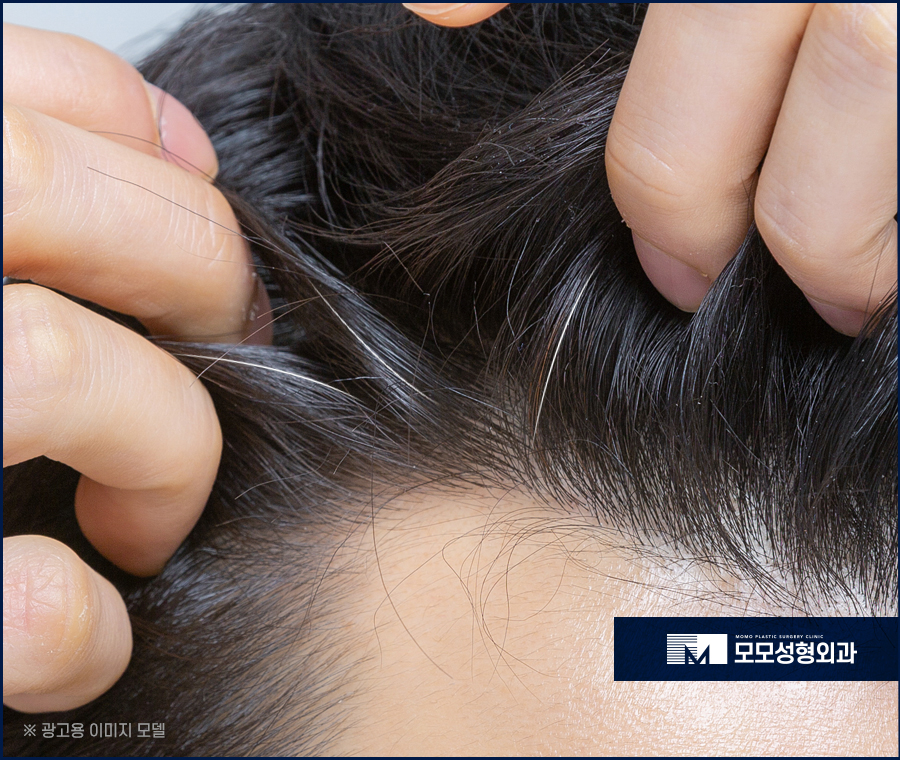 새치염색주기 무리를 주지 않는 선은 관련 이미지 2