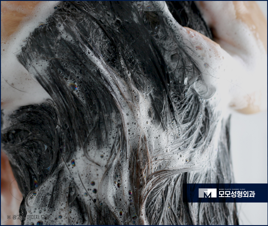 모발이식생착기간 기준에 대해서 관련 이미지 7