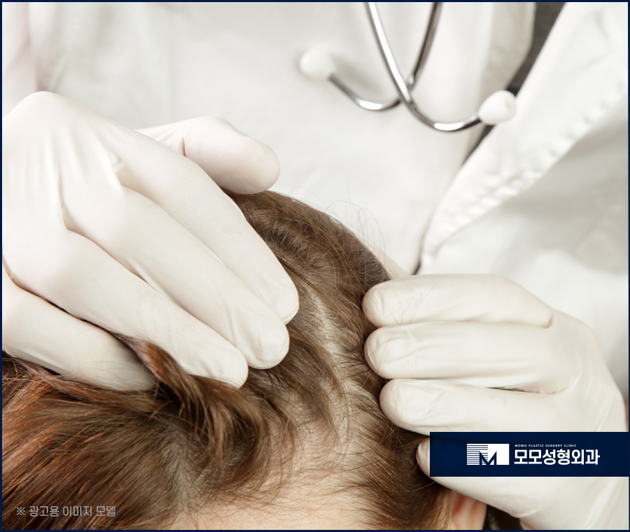 미녹시딜여자 효과와 치료 방안에 대해 관련 이미지 6