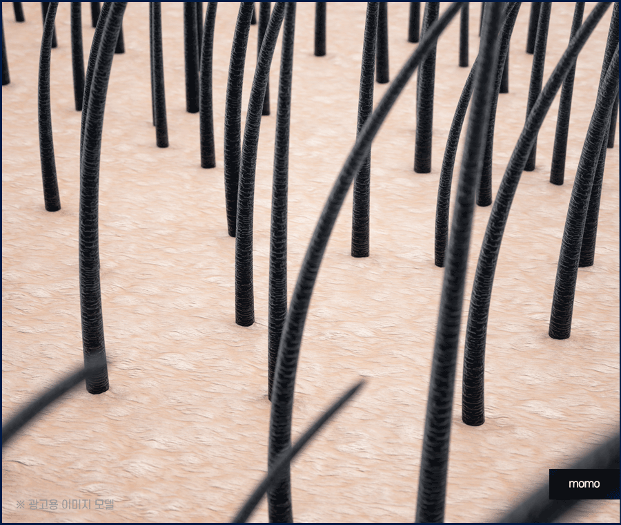 모발이식 생착률 높이기 위한 솔루션은 관련 이미지 2