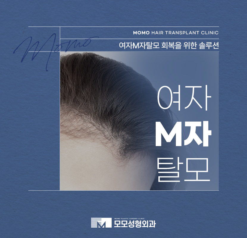 여자M자탈모 회복을 위한 맞춤 솔루션 관련 이미지 1