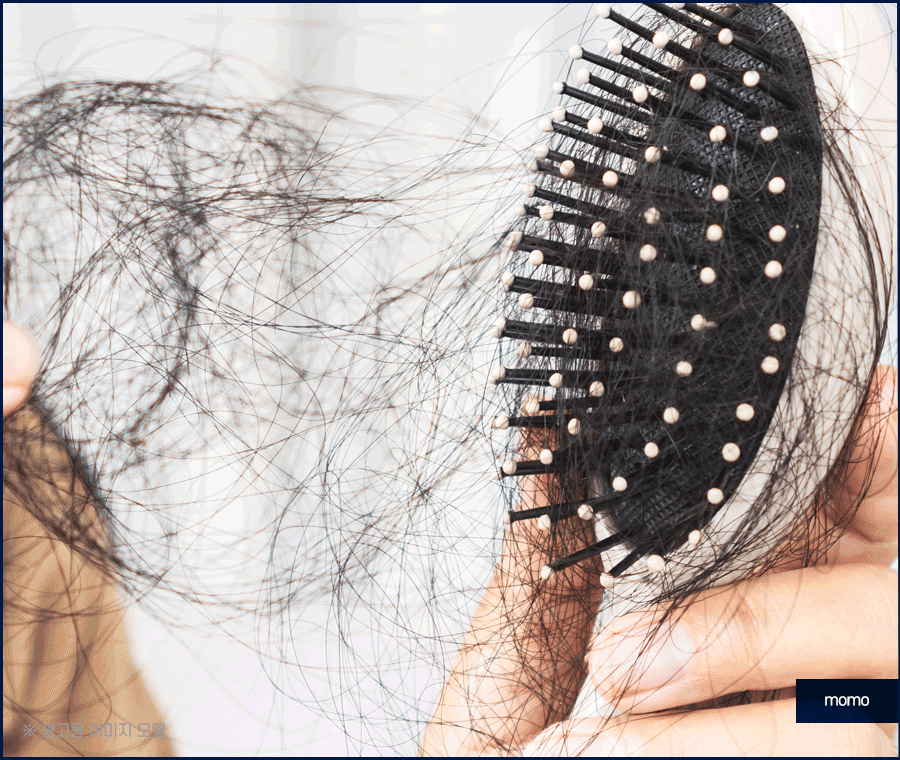 여자 정수리 탈모 초기 증상 및 머리카락빠짐 대응 방안 관련 이미지 3