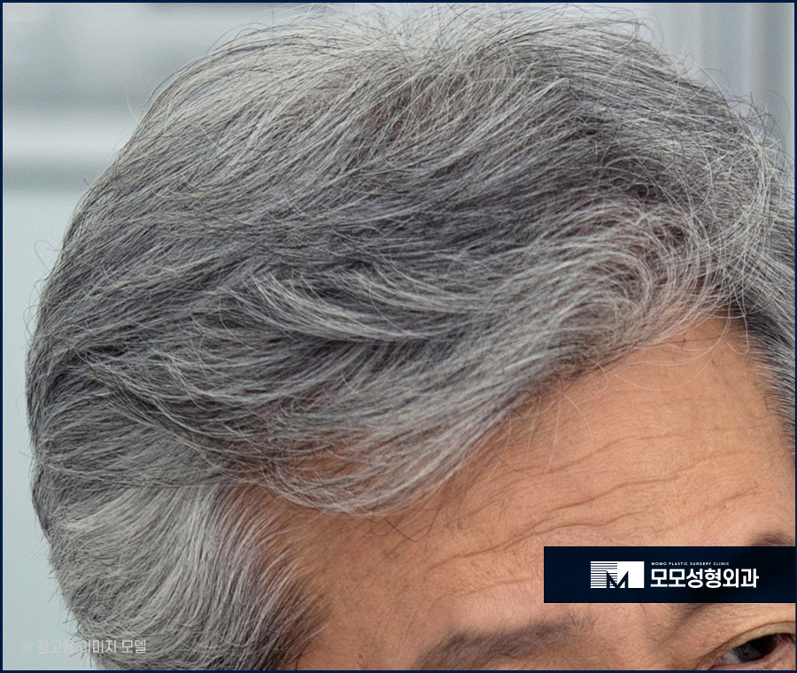 흰머리나는시기와 예방하는 방안 관련 이미지 9