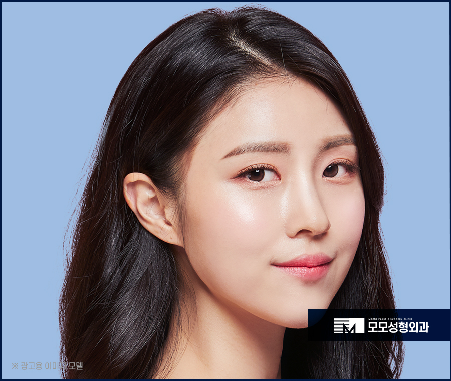 여성헤어라인교정 자연스러운 예후로 관련 이미지 2