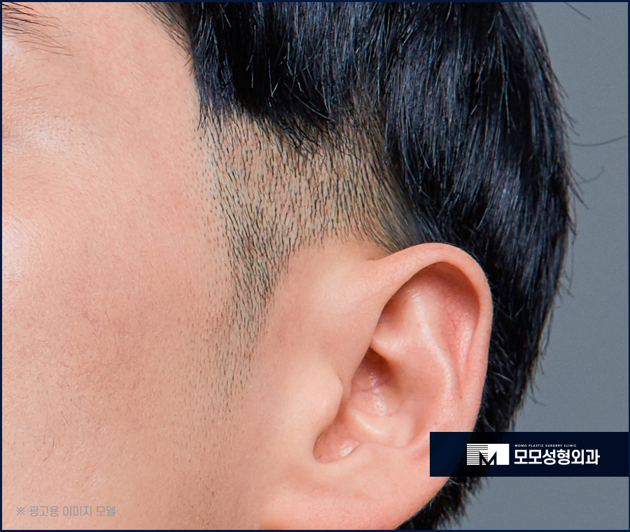 남자 옆머리 탈모 구레나룻의 양이 부족하다고 느껴질 경우엔 관련 이미지 3