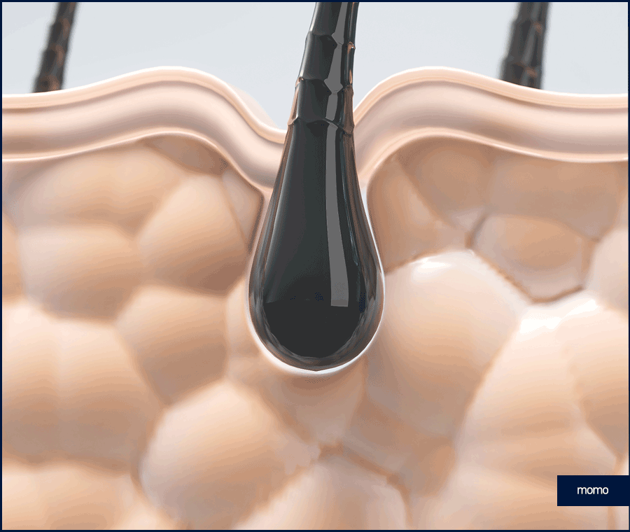 강남 탈모 병원 원인 파악부터 철저하게 시작하는 곳 관련 이미지 2