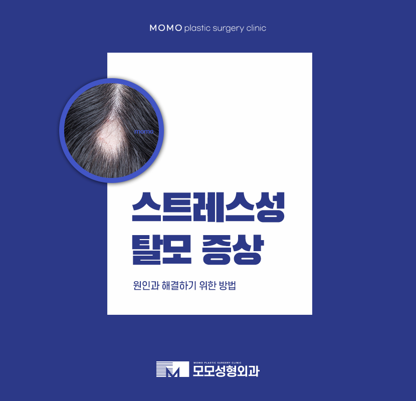 스트레스성탈모증상 다양하게 나뉘어 지는 관련 이미지 1