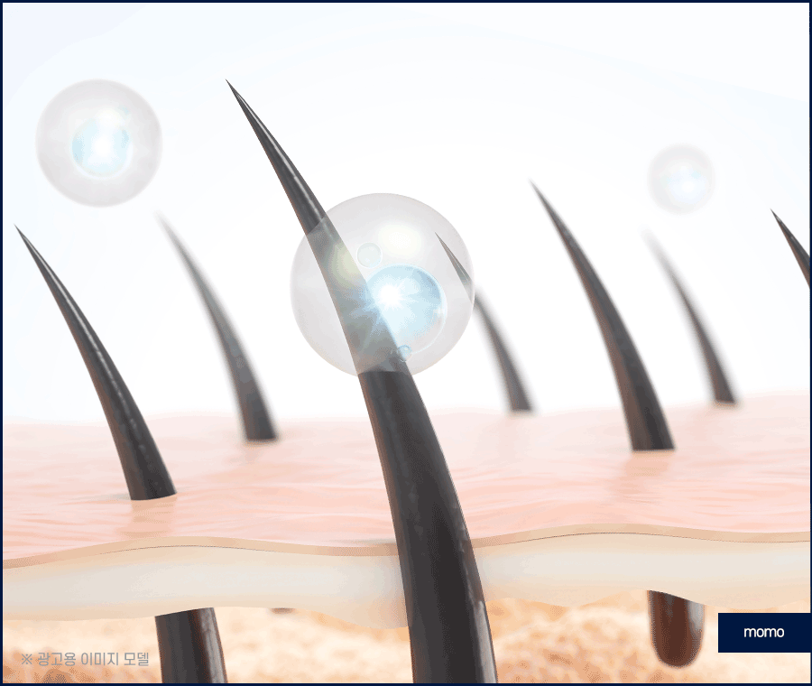 헤어라인 모발이식 비용보다 꼼꼼히 알아볼 조건은? 관련 이미지 8