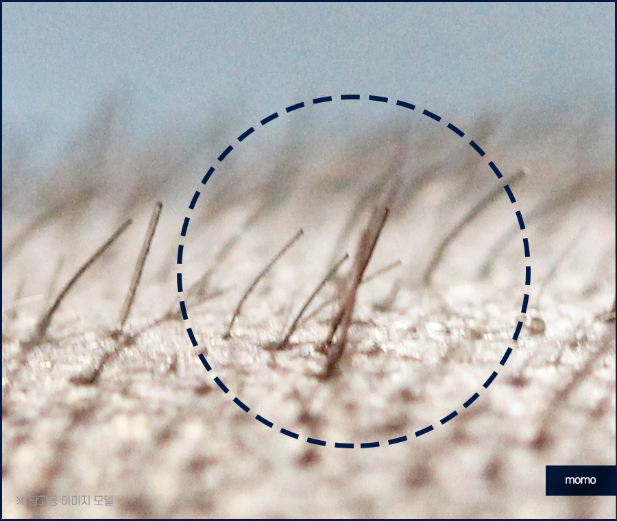 머리카락 얇아짐 발생하는 이유부터 회복 방안 관련 이미지 9