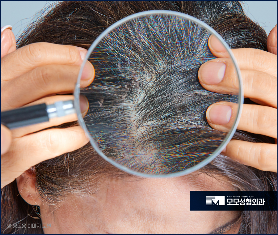 흰머리나는시기와 예방하는 방안 관련 이미지 4