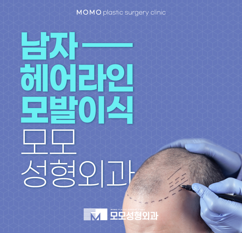 남자헤어라인모발이식 합리적인 판단으로 관련 이미지 1