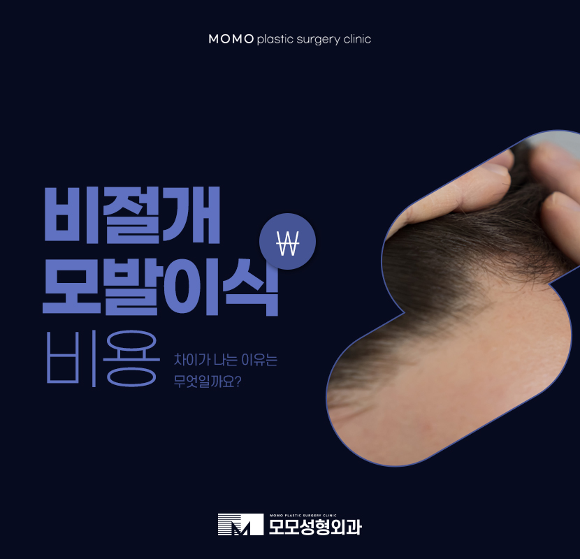 비절개모발이식비용 어느 정도 차이가 날까 관련 이미지 1