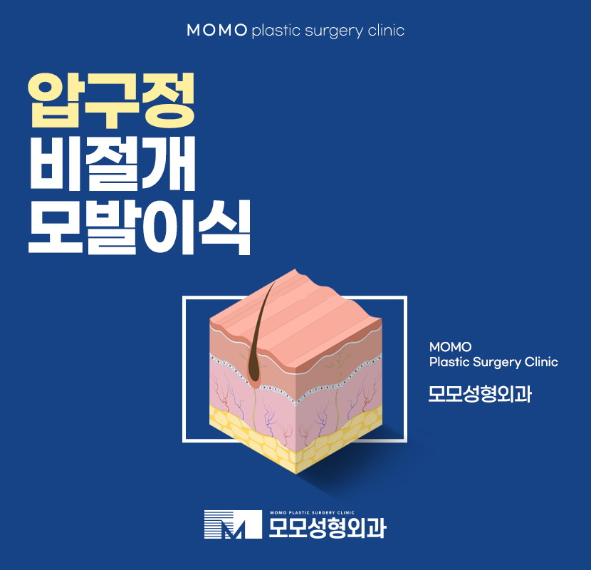 압구정비절개모발이식 고민을 극복하기 위한다면 관련 이미지 1