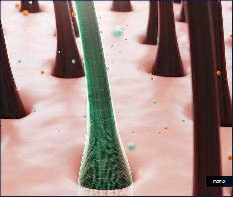 압구정역 모발이식 방법 및 생착률을 높이는 팁 관련 이미지 4