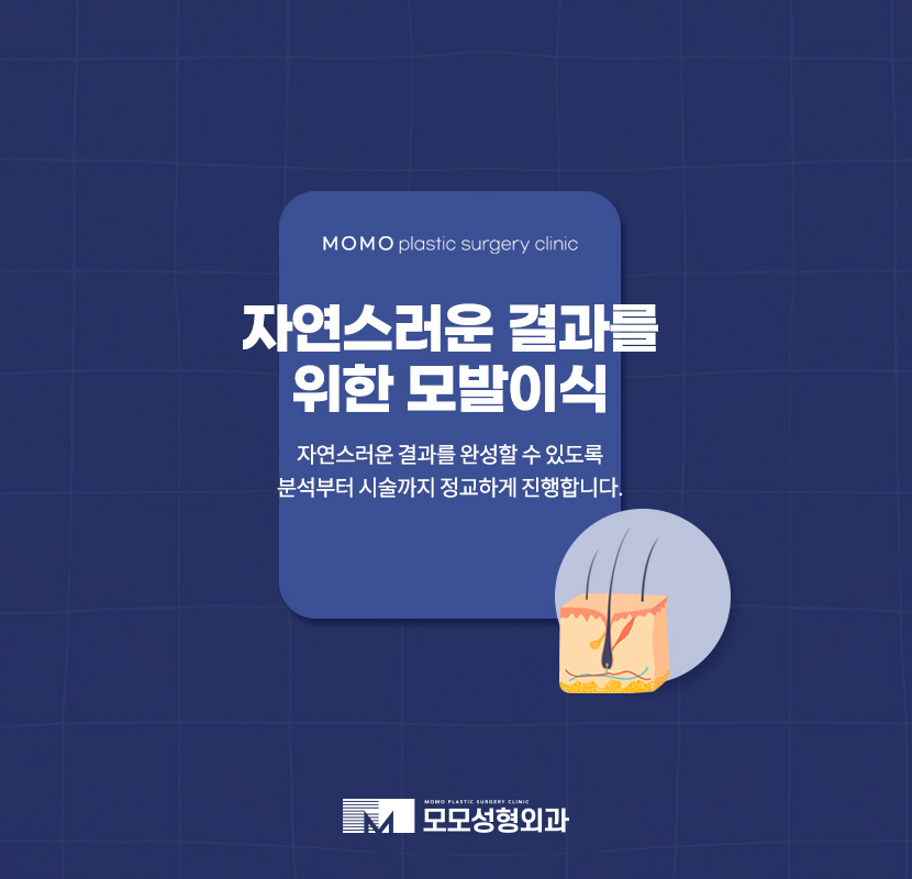 신사모발이식 자연스러움까지 얻어내기 위한 관련 이미지 1