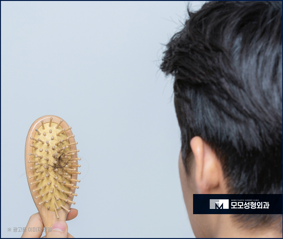 서울탈모병원추천 중요 포인트는 관련 이미지 2