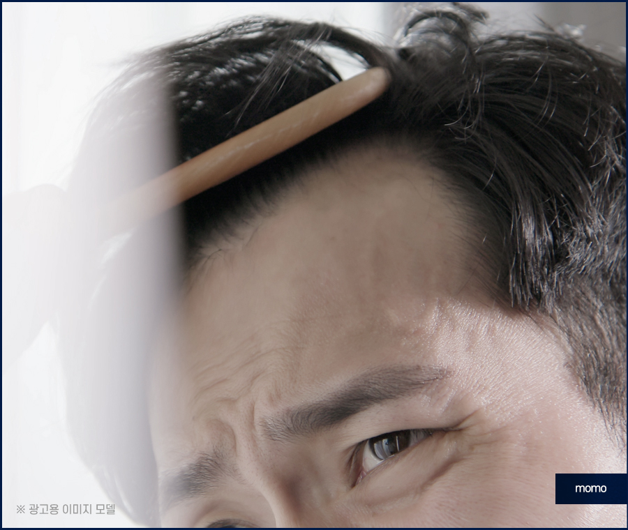 모발이식 생착기간 생착률 및 주의할 점 확인 관련 이미지 10