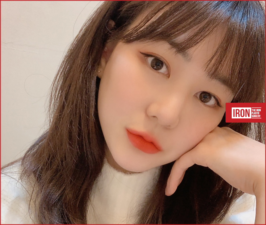 압구정눈성형 알맞은 밸런스로 관련 이미지 2