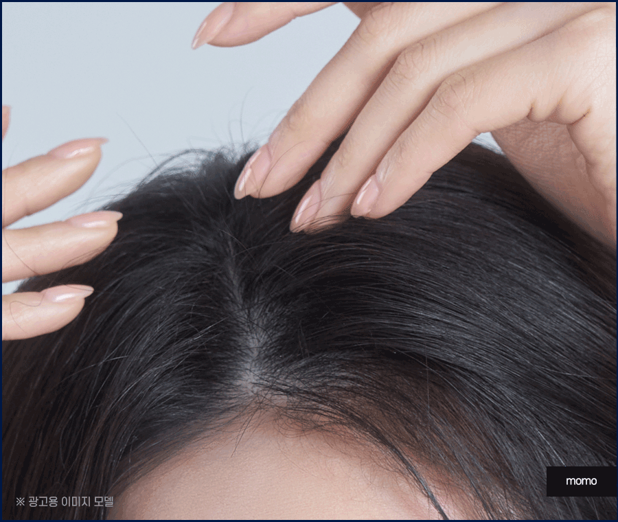 모발이식병원추천 개인에게 맞춰 진단하는 곳으로 관련 이미지 3