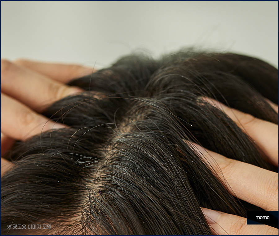 머리 간지러움 원인과 빠른 증상 해소를 위한 tip 관련 이미지 5