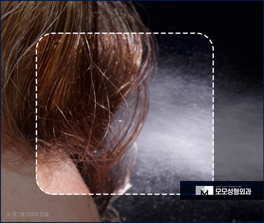 우습게 여기지 말아야 할 헤어라인 뾰루지 관련 이미지 6