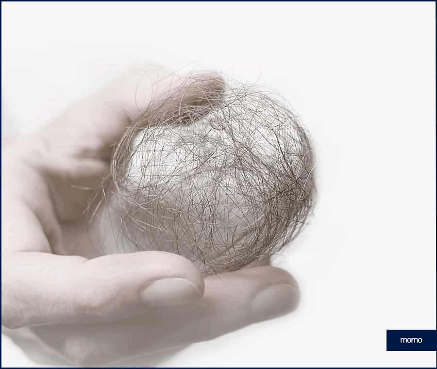 모발이식 생착기간 섬세한 관리가 필요한 이유 관련 이미지 2