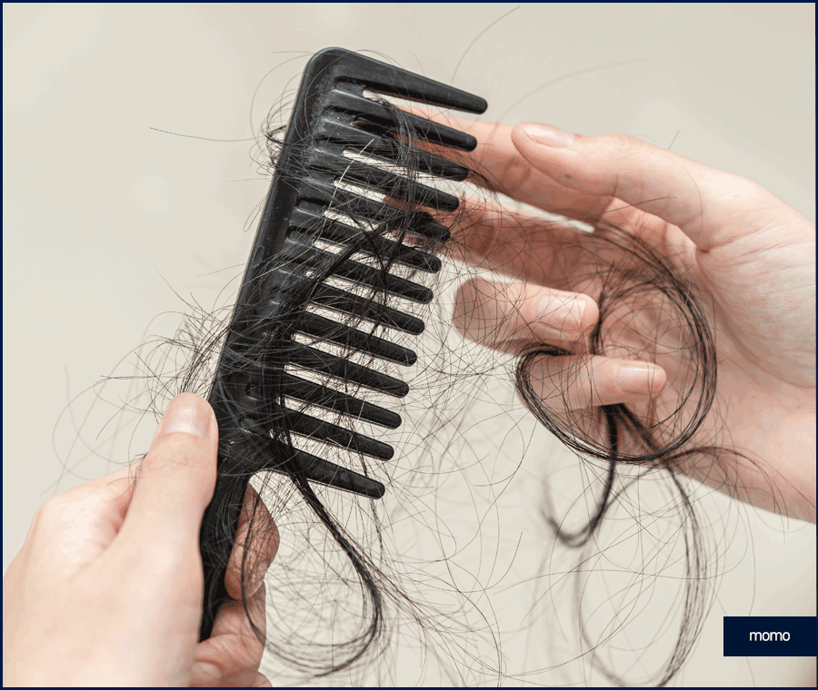 탈모 클리닉 비용의 기준이 되는 조건은? 관련 이미지 3