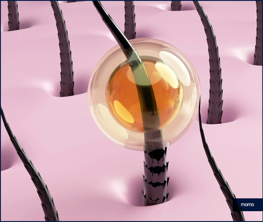 돼지털 머리카락 원인 및 완화하는 방법 3가지 관련 이미지 8