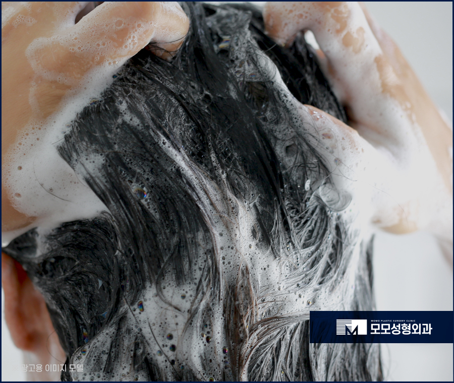 모발이식개구리알 발생 이유와 생착률과의 관계 관련 이미지 6