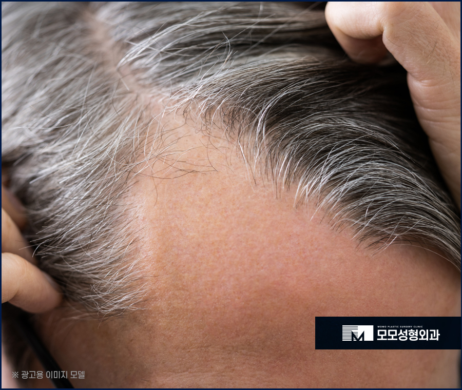 흰머리나는시기와 예방하는 방안 관련 이미지 11