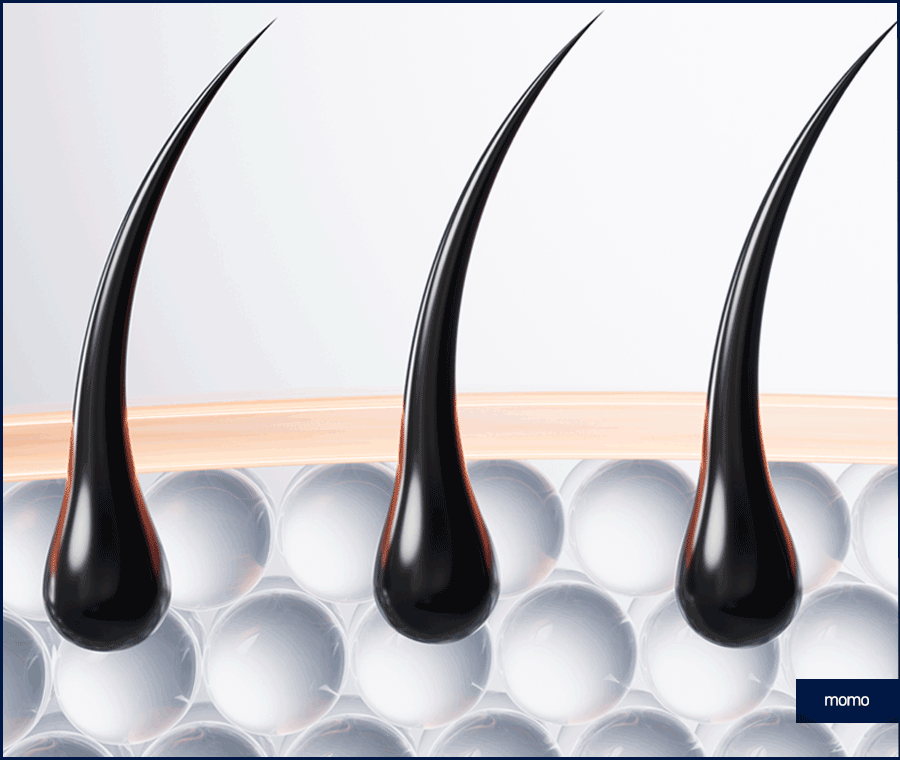 탈모약 처방 병원 꼼꼼한 진단하는 곳을 찾는다면 관련 이미지 9