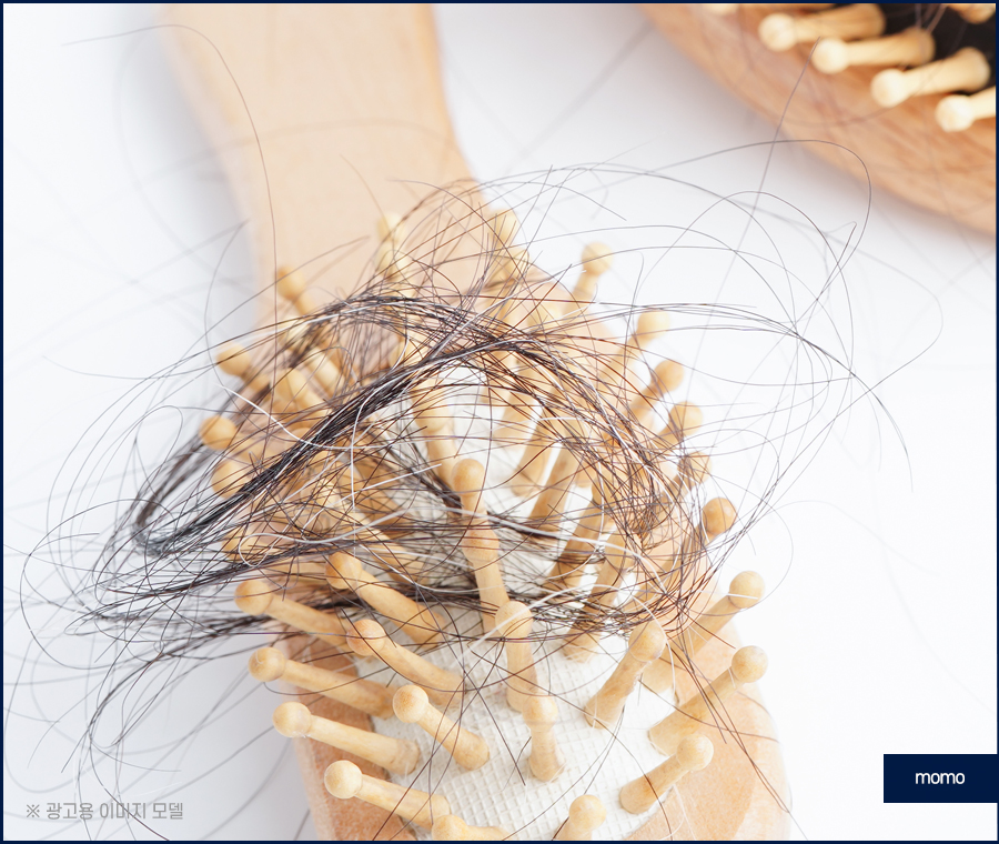 여자 정수리 탈모 모발이식 꼼꼼히 채우는 관련 이미지 2