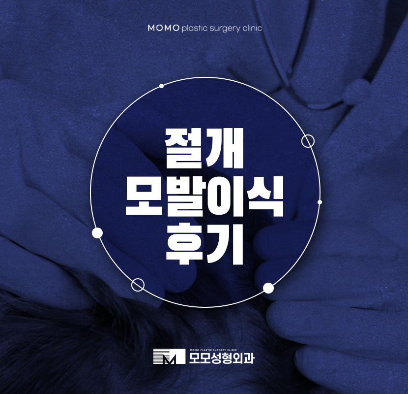 절개모발이식후기 전후 변화를 체크하며 관련 이미지 1