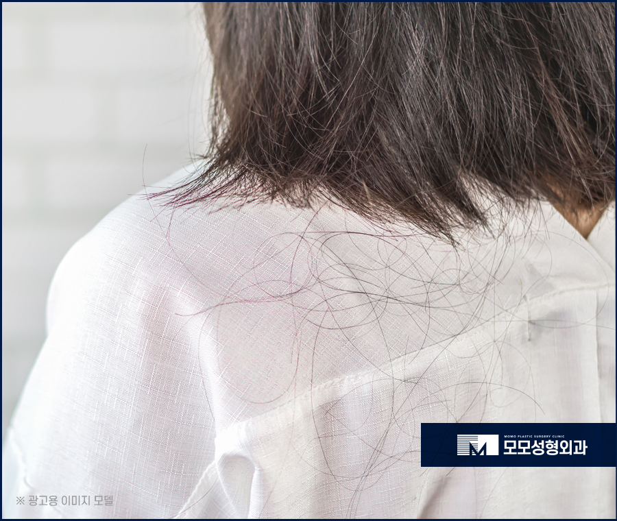 모발이식생착기간 여유를 가지고 기다려야하는 관련 이미지 2