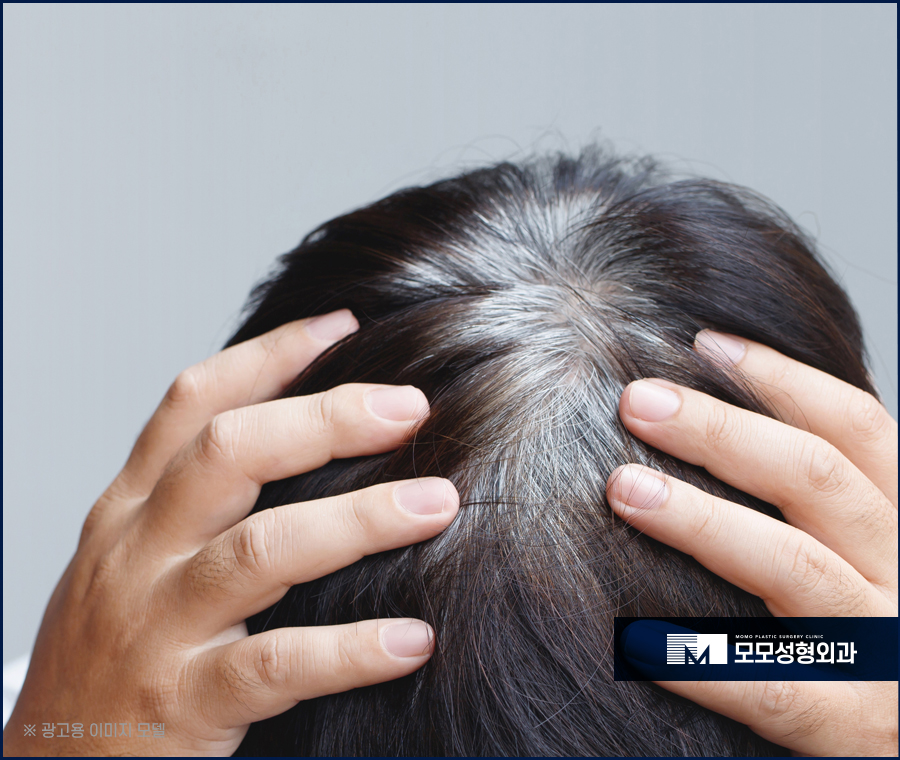 흰머리 가려움 어떻게 완화시킬 수 있을까요 관련 이미지 3