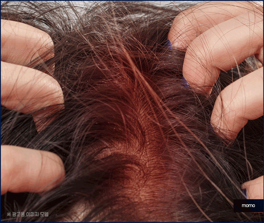 산후 탈모 언제까지 유지되는지 원인 및 대처법 관련 이미지 7