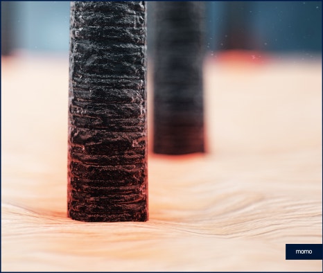 압구정역 모발이식 방법 및 생착률을 높이는 팁 관련 이미지 3