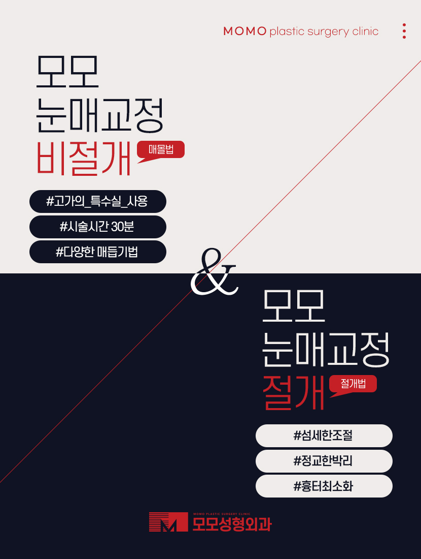 눈매교정 후 관리 철저하게 이뤄져야 관련 이미지 5