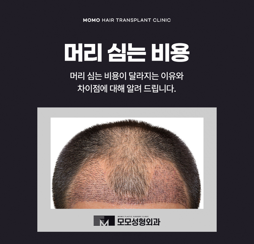 머리심기비용이 달라지는 이유와 차이점 관련 이미지 1