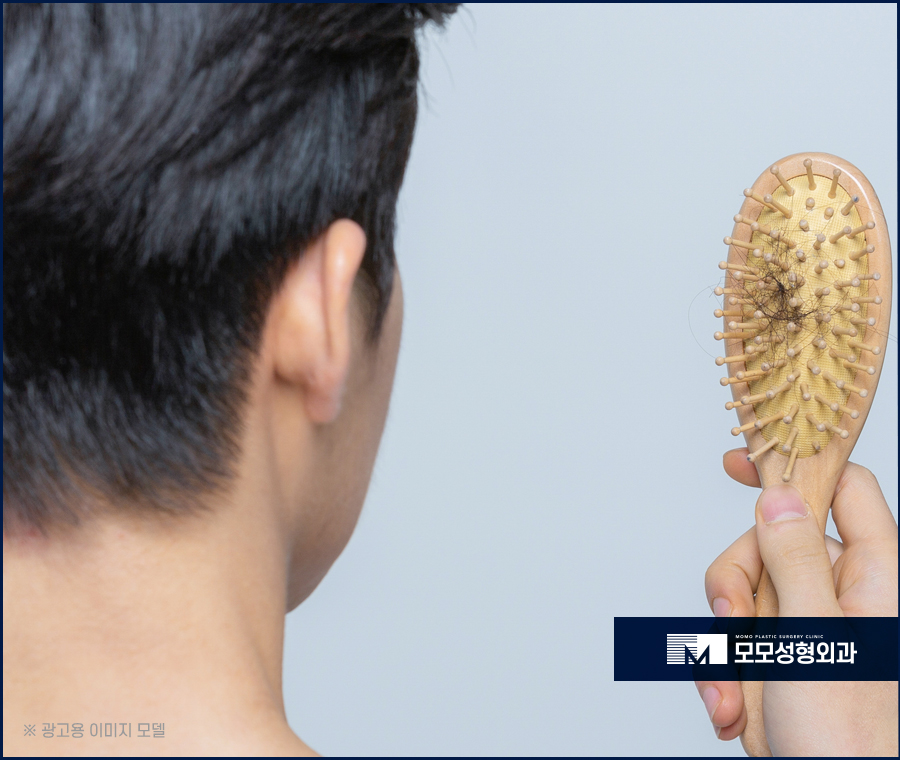 머리심기비용 방식에 따라 나뉘어지는 관련 이미지 2