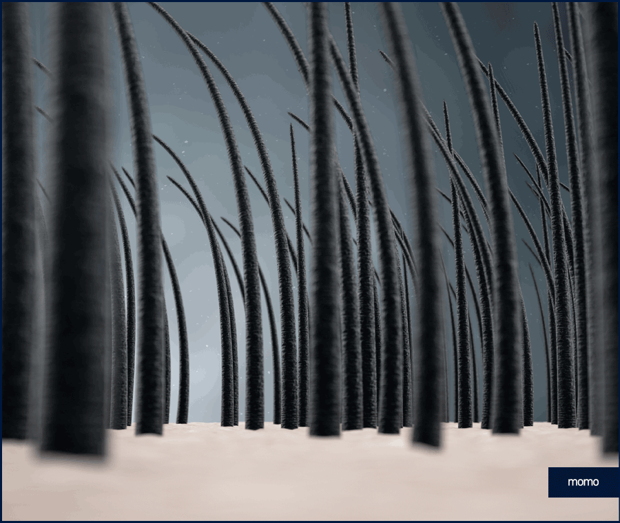 여자 측두부 탈모 아름다운 옆모습을 만드는 방법 관련 이미지 9