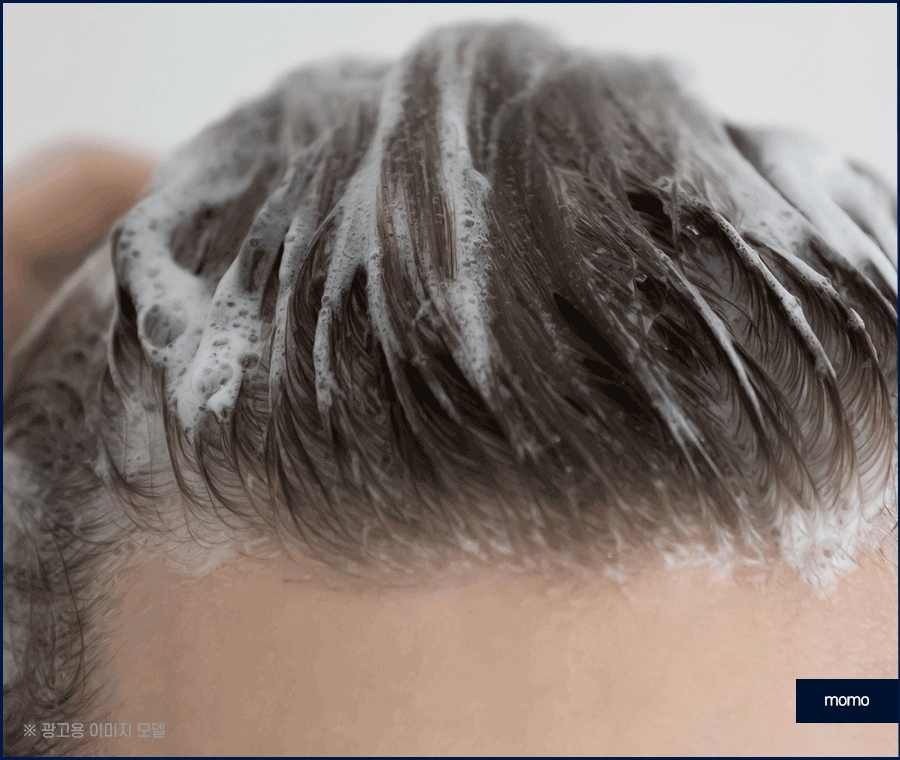 두피피딱지 원인 및 올바른 케어 방법은? 관련 이미지 12