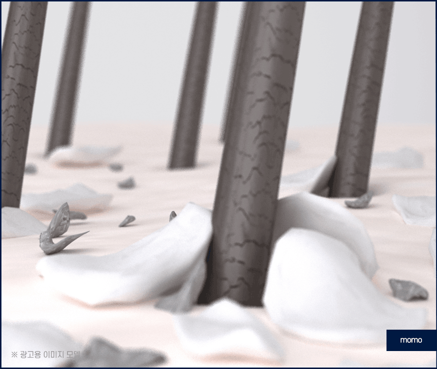 압구정 탈모병원 보완을 위한 최선책은? 관련 이미지 5