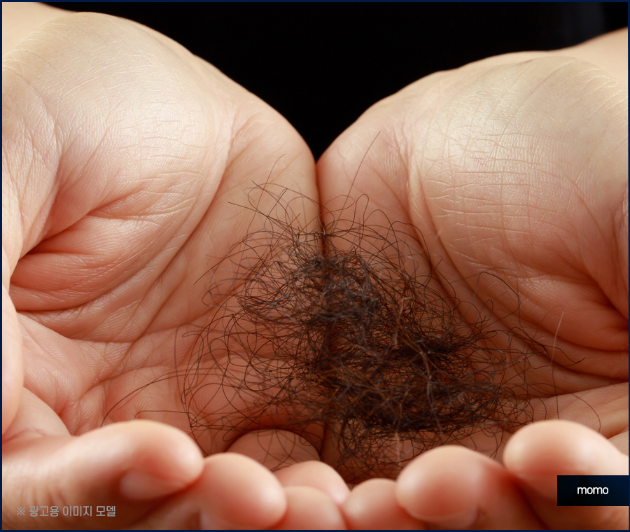 돼지털 머리카락 원인 및 완화하는 방법 3가지 관련 이미지 3