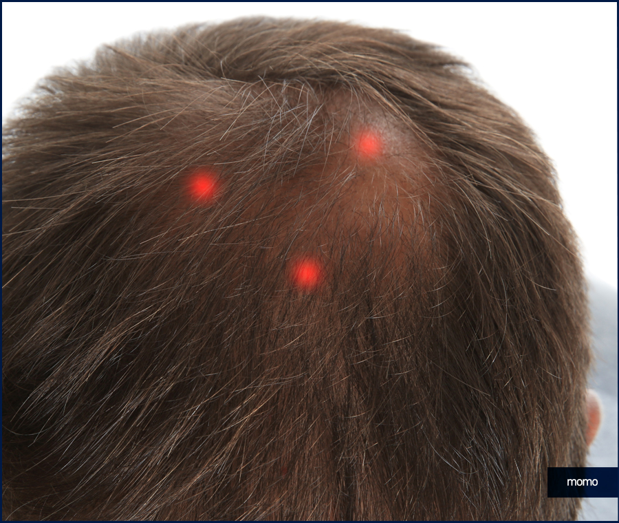 두피 누르면 통증이 느껴질 경우 위험한 이유 관련 이미지 8