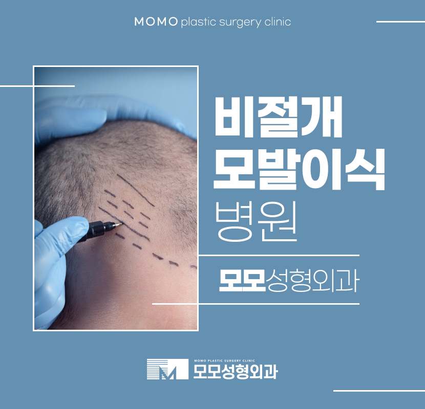 비절개모발이식병원 직접적인 변화를 관련 이미지 1