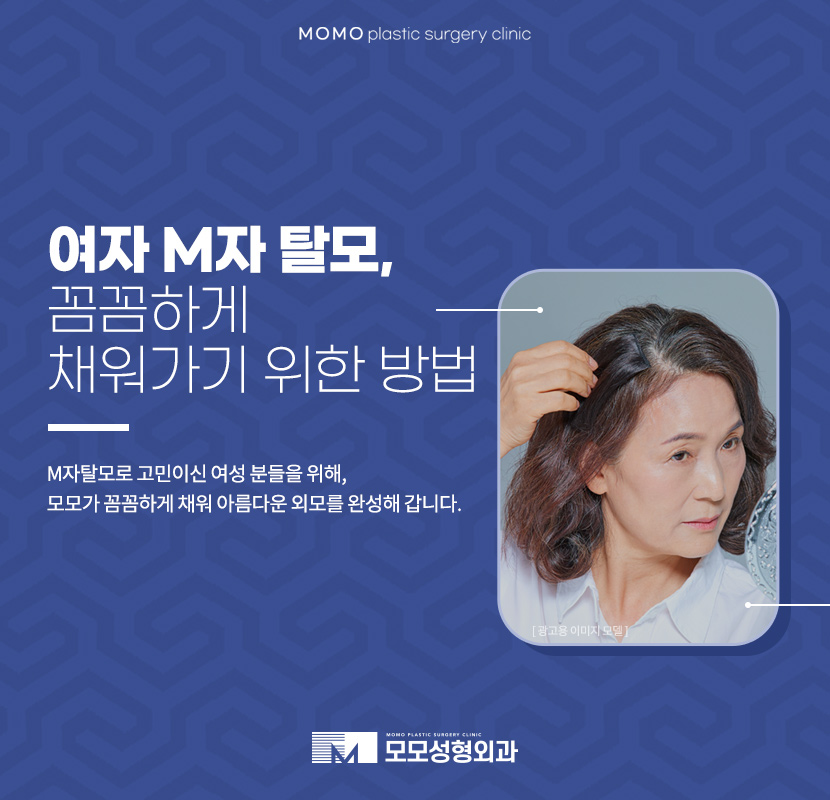 여자M자탈모 외모의 퀄리티를 더하는 보강 방법 관련 이미지 1