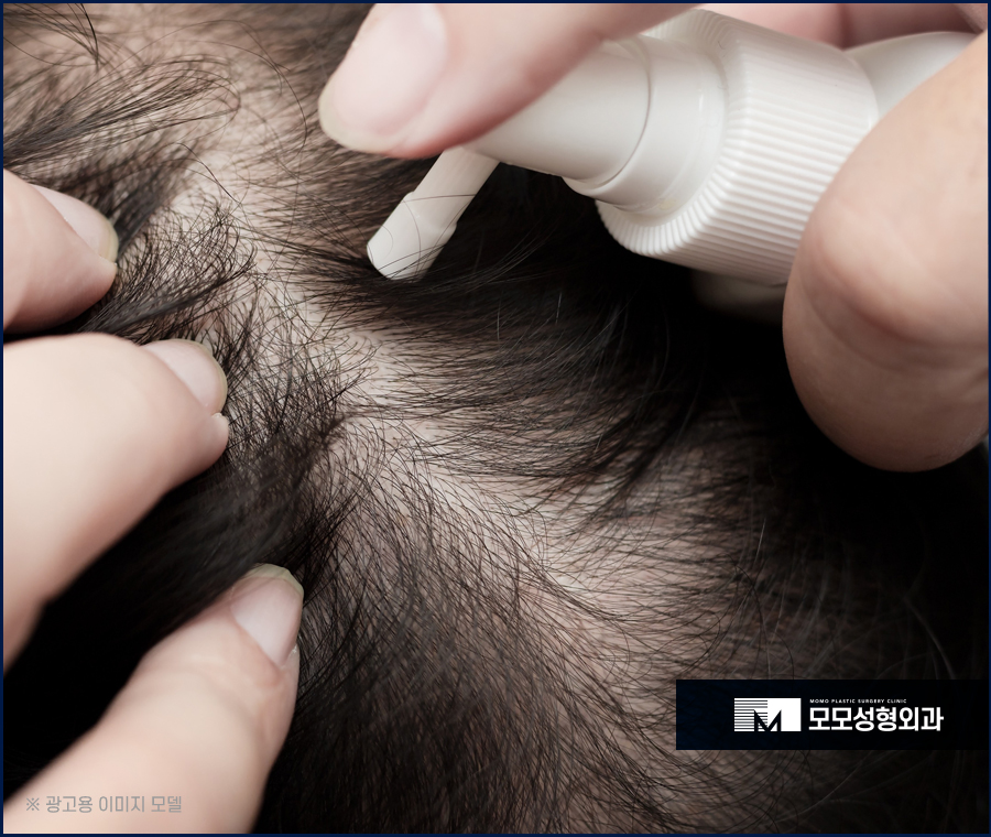 강남탈모병원 진단부터 섬세한 곳에서 해야만 관련 이미지 2